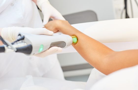 depilacion laser candela buenos aires